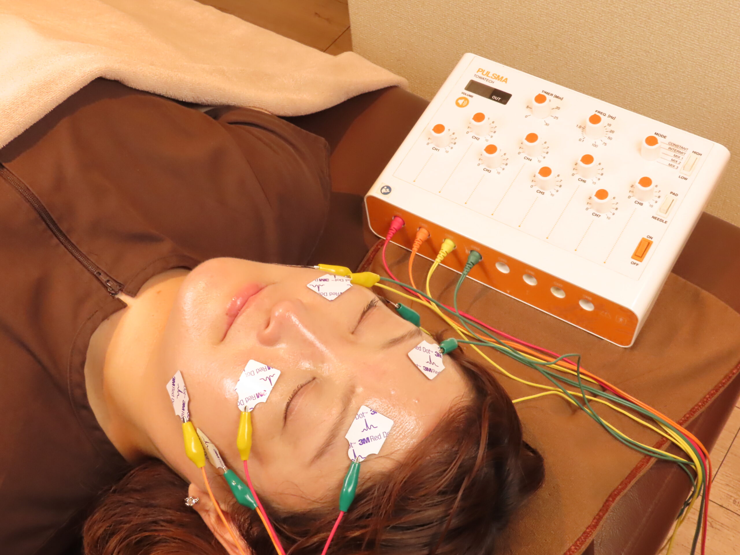 サクラダ治療室の美容鍼(電気を用いた施術)