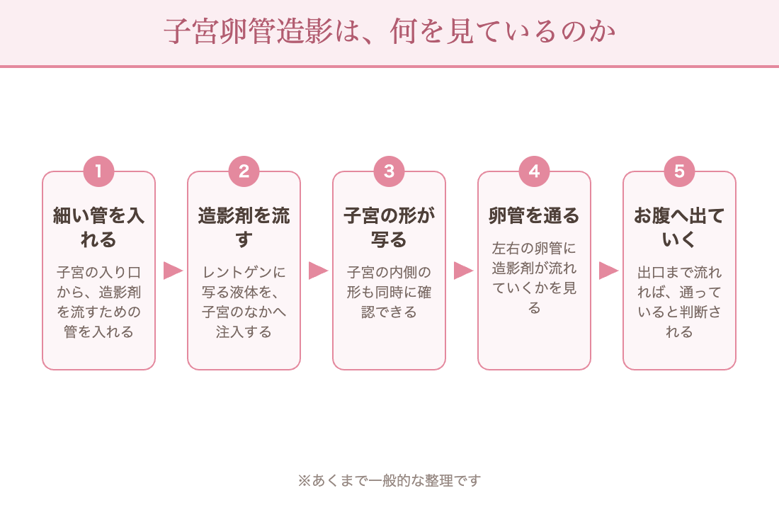 子宮卵管造影の流れ:子宮の入り口から細い管を入れる→造影剤を流す→子宮の内側の形が写る→左右の卵管を通る→お腹のなかへ出ていく